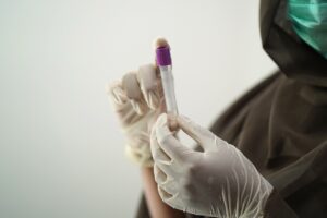 脂肪吸引のお腹に必要な術前検査とは？