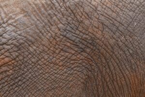 脂肪吸引後のお腹の皮膚たるみを改善する方法は？