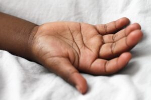 脂肪吸引後のお腹の皮膚たるみを解消する方法は？