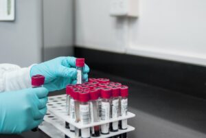 脂肪吸引お腹リゾートでの手術はどのようなものですか？