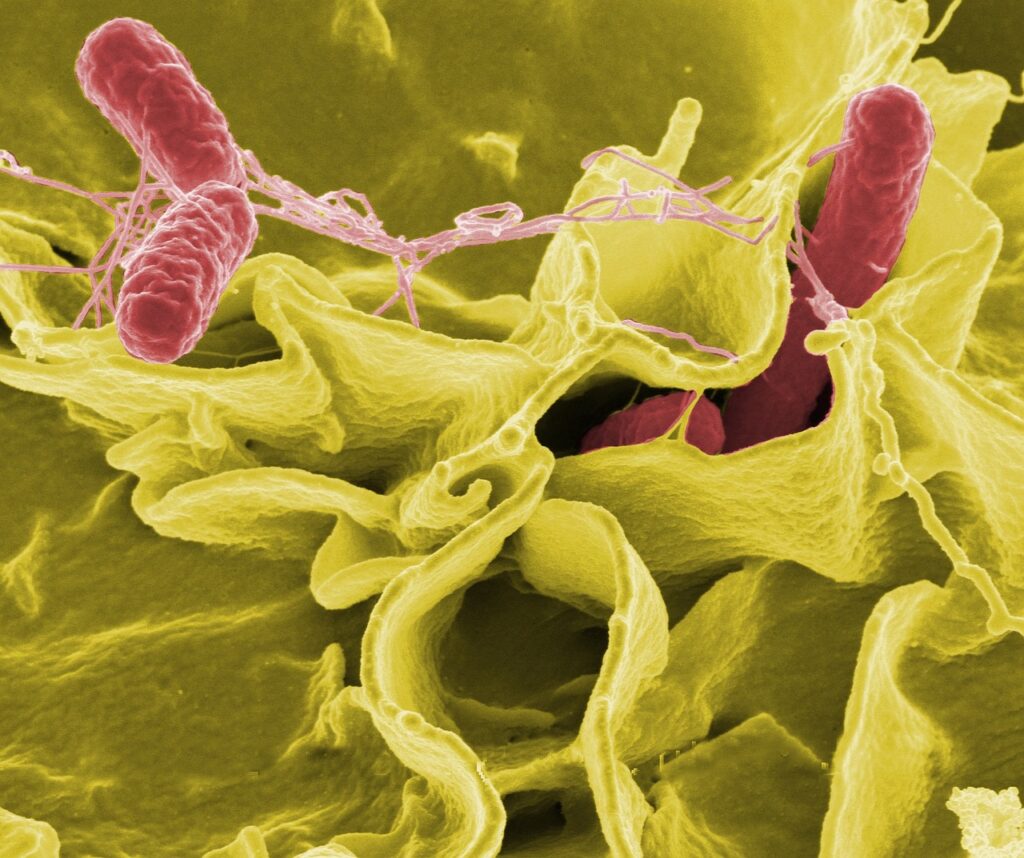 脂肪吸引でお腹の感染症リスクを減らす方法は？