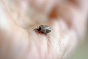 脂肪吸引のお腹における感染症リスクとは？